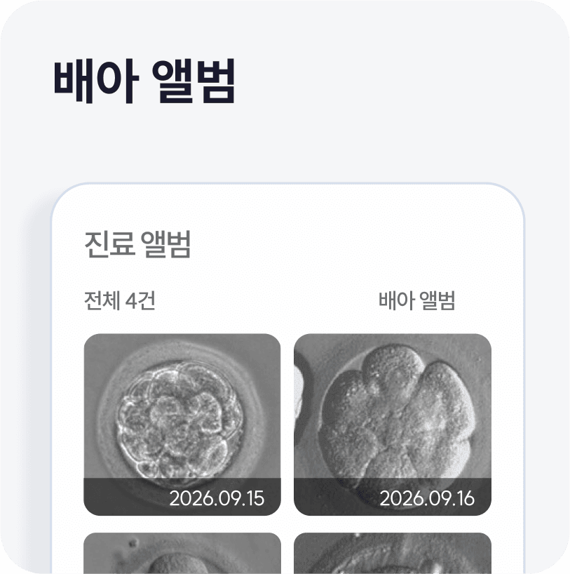 배아 앨범
